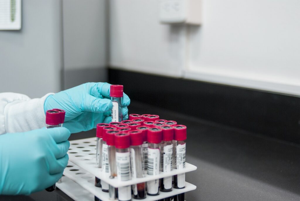 lab, experiment, test, chemistry, test tubes, laboratory, hands, gloves, surgical gloves, blood samples, lab, lab, lab, lab, lab, chemistry, laboratory, laboratory, laboratory, laboratory
